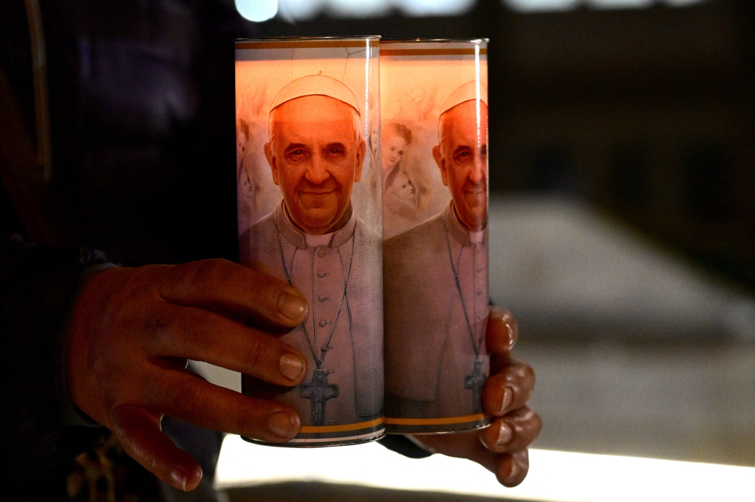 Pope Francis, Pneumonia, Double Pneumonia, Lung Infections, Bilateral Pneumonia, Respiratory Infection, Polymicrobial Infection, Sciatica, Diverticulitis, Colon Surgery, Knee Pain, Bronchitis, Abdominal Surgery, CT Scan, Hematoma