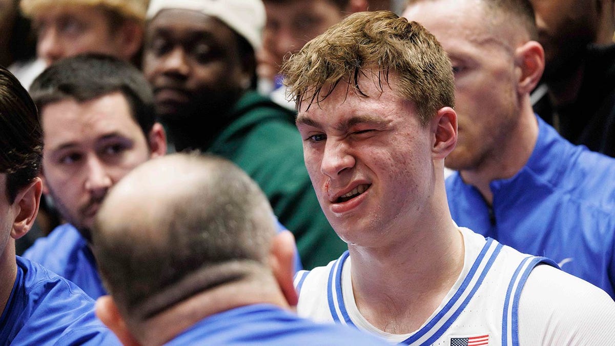 Cooper Flagg, Duke Blue Devils, basketball, eye injury, Florida State, Sion James, Jon Scheyer, NBA Draft, 2025 NBA Draft, NCAA Tournament, college basketball, sports news, Fox News
