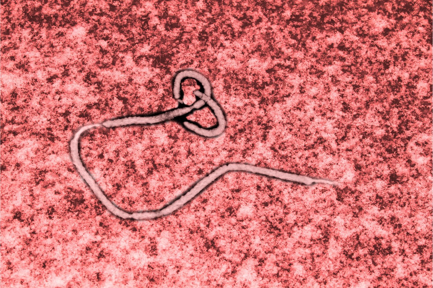 Ebola, obeldesivir, antiviral, treatment, cure, Zaire ebolavirus, hemorrhagic fever, research, study, monkeys, primates, University of Texas Medical Branch, Science Advances, vaccine, outbreak, Sudan virus, Marburg, zoonotic disease, infectious disease, public health
