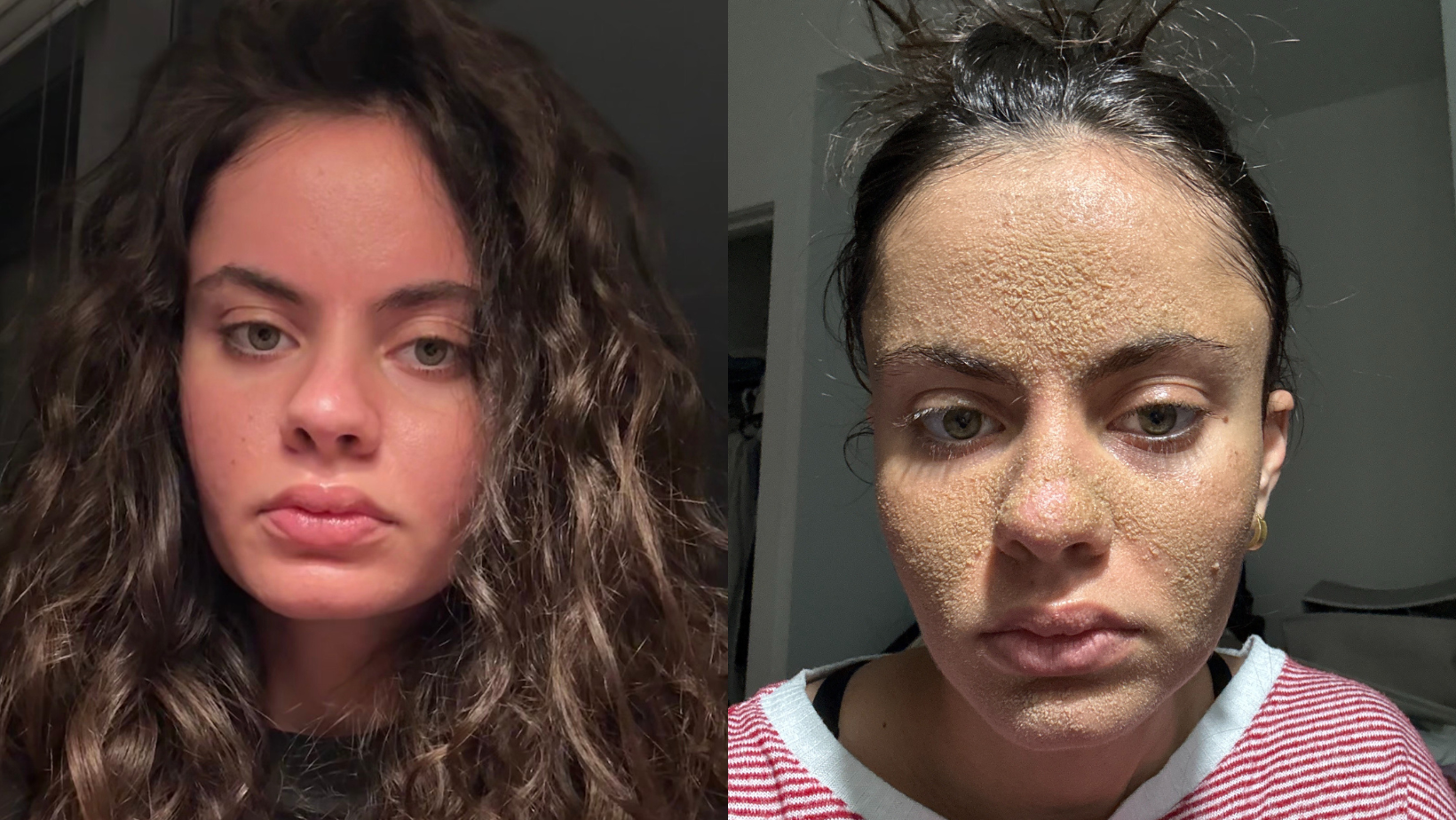 Caveman Method, skincare routine, Tia Zakher, retention hyperkeratosis, TikTok, skin-picking, dermatologist, Marisa Garshick, Stephanie Kosack, skin health, facial cleansing, skin barrier, Kelsie Carolos, beauty trends, no-wash method, dead skin cells, clogged pores, moisturizer, acne, viral trends.
