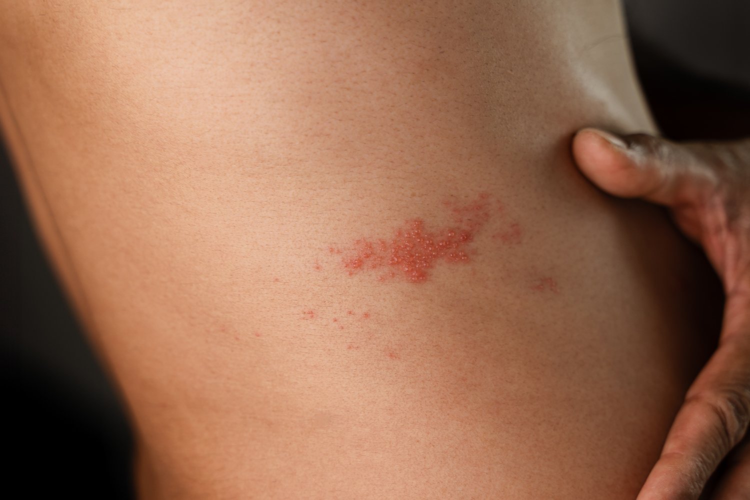 shingles vaccine, cardiovascular disease, heart attack, stroke, Zostavax, Shingrix, varicella zoster virus, shingles, vaccination, heart health, South Korea, Kyung Hee University, Sooji Lee, European Heart Journal, dementia, Alzheimer's disease, public health, inflammation, blood clots, nerve damage
