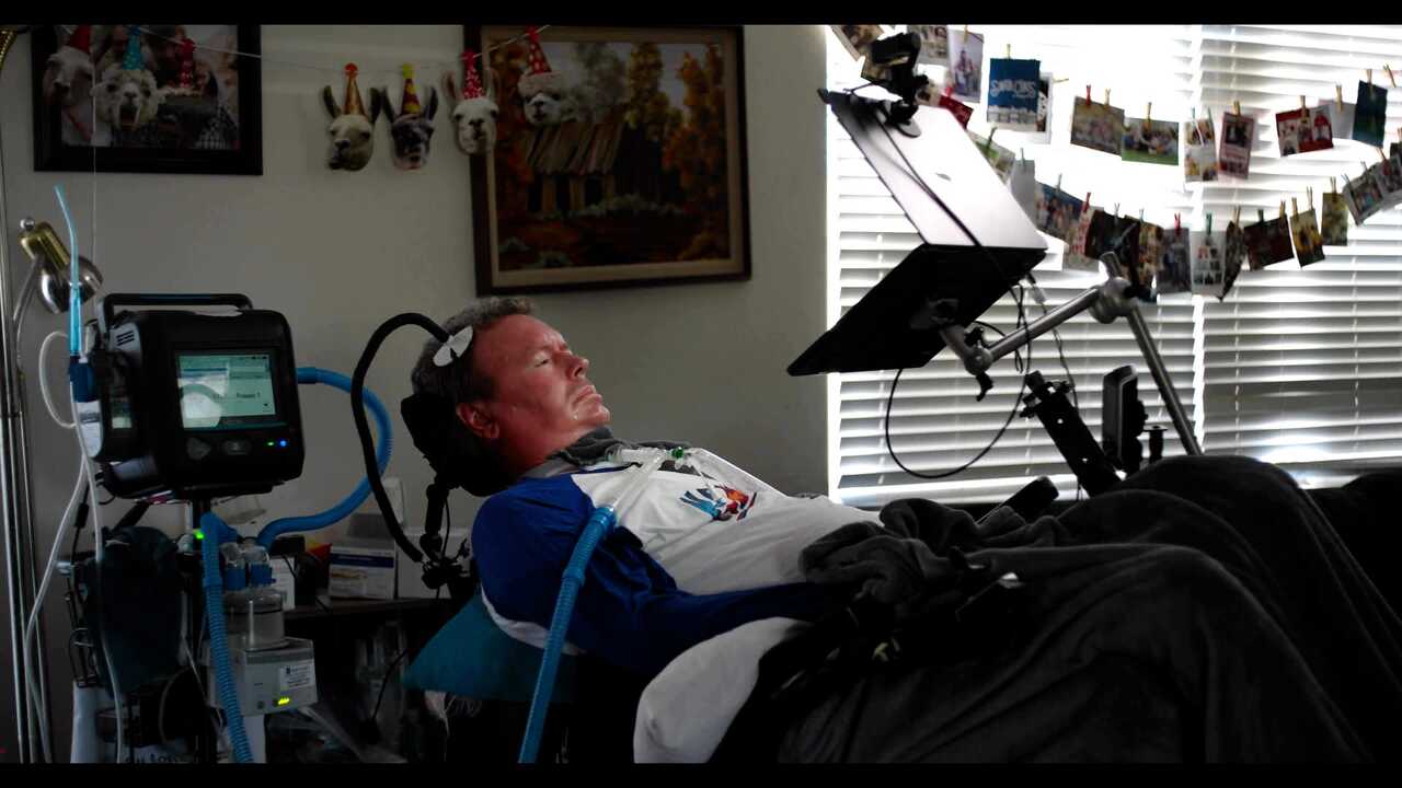 Neuralink, brain-computer interface, BCI, ALS, Bradford G. Smith, human trial, AI voice, voice synthesis, assistive technology, paralysis, digital accessibility, PRIME, CONVOY, brain signals, thought control, neurological disorders, technology innovation, medical breakthrough, YouTube video, patient application, independent living
