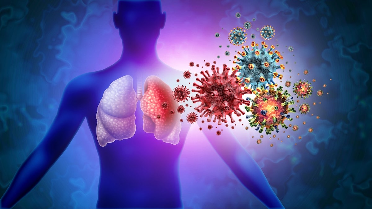 Aspergillus, Aspergillosis, fungal infection, lung infection, climate change, global warming, immunosuppressed, antifungal resistance, fungal mold, health, medicine, pneumonia, allergy, asthma, treatment, diagnosis, research, elderly, soil, prevention, spores, mortality, risk factors, Jacob Glanville, Jatin M. Vyas, Cornelius Clancy, Centivax, Columbia University, VA Pittsburgh Health System
