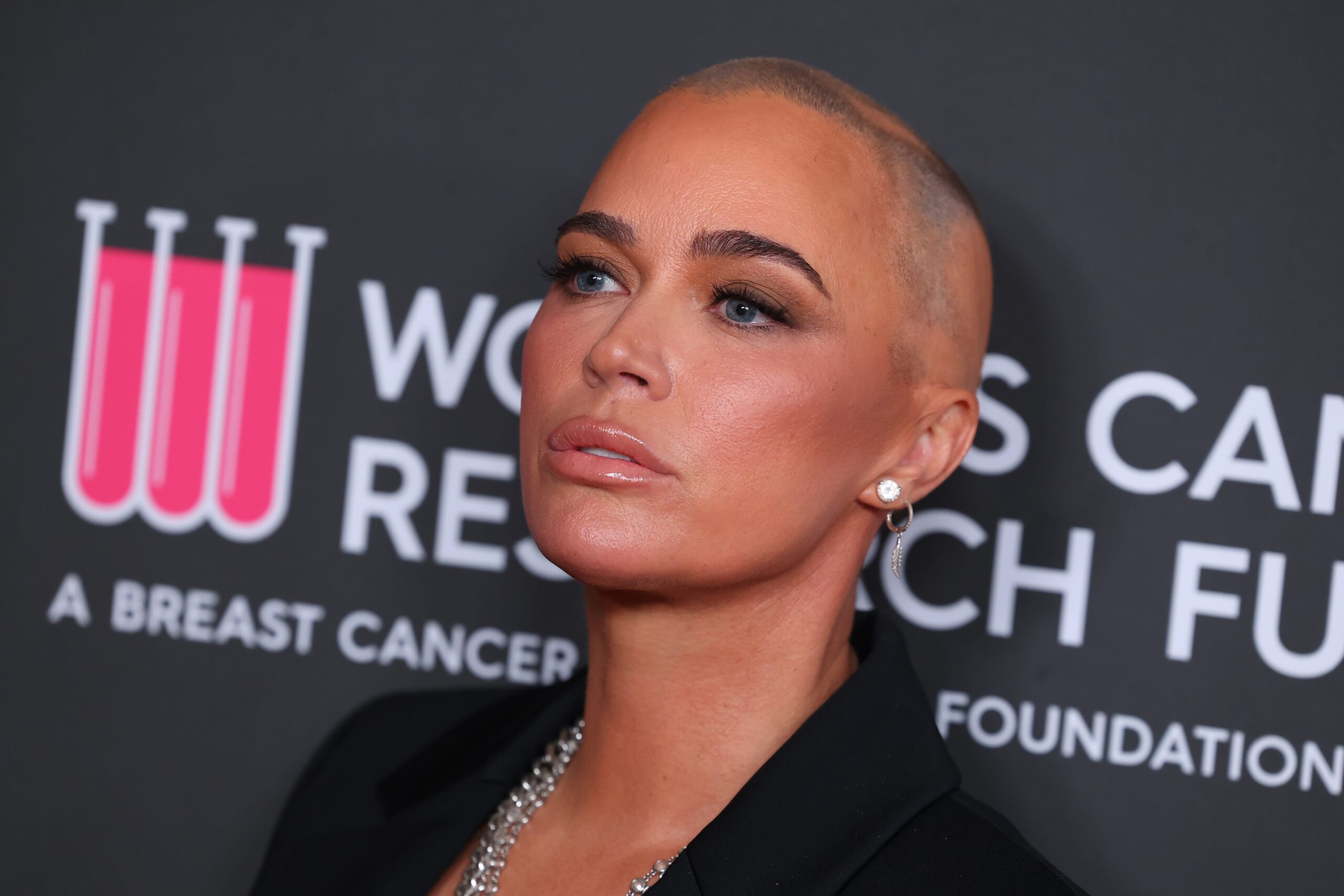 Teddi Mellencamp, melanoma, skin cancer, Real Housewives of Beverly Hills, cancer diagnosis, stage 4 cancer, cancer treatment, immunotherapy, health, wellness, Kyle Richards, tumors, cancer awareness, early detection, medical advice, cancer prognosis, health tips, celebrity health, John Mellencamp.
