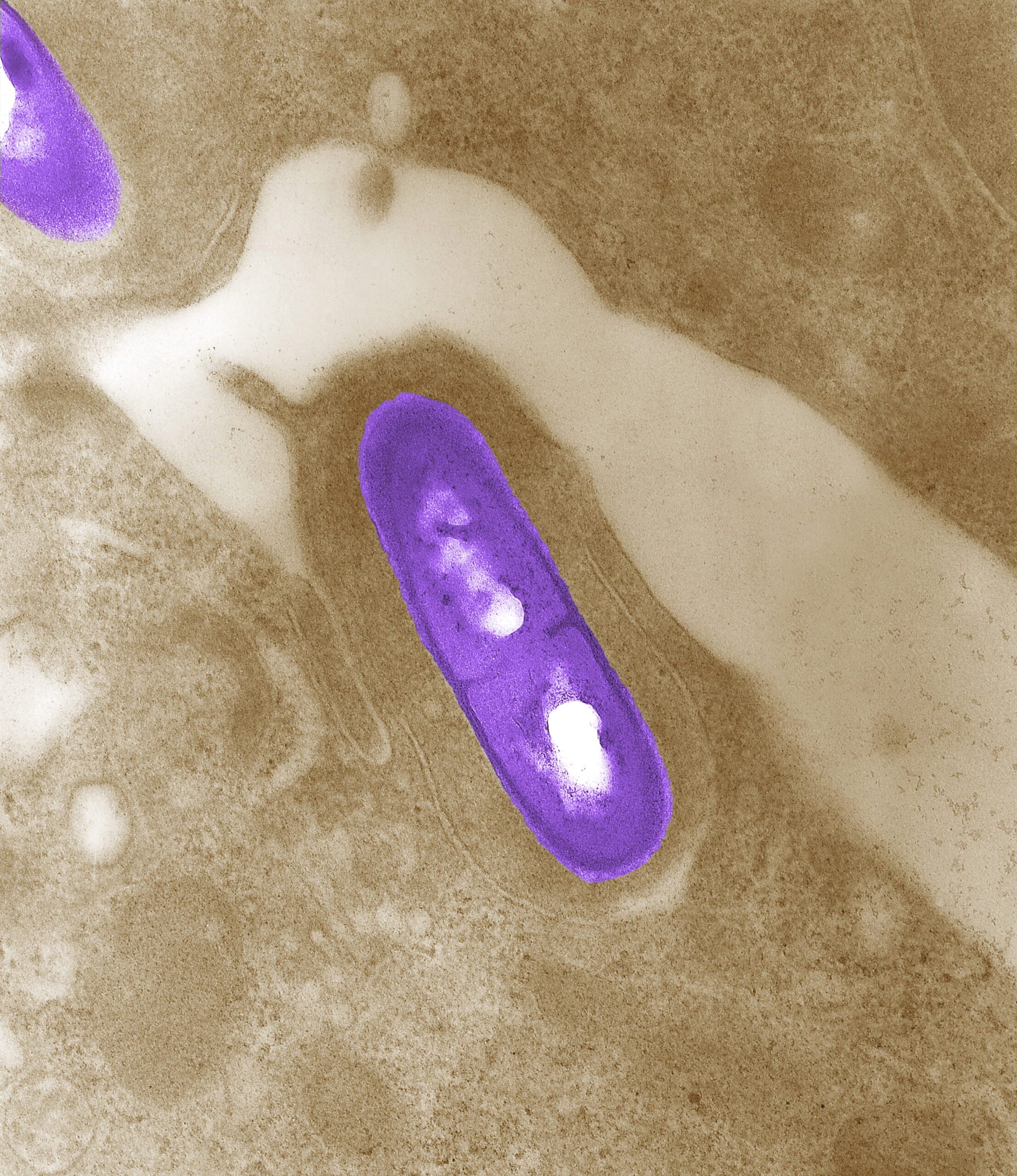 listeria outbreak, food recall, Fresh & Ready Foods, FDA, CDC, food safety, listeriosis, ready-to-eat food, California, Nevada, Arizona, Washington, hospitalizations, food poisoning, contaminated food, foodborne illness, health advisory
